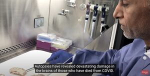 Covid impact on the brain Science Magazine